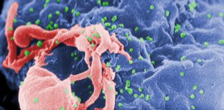 HIV-budding-Color.jpg